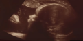 اضغط على الصورة لعرض أكبر.&nbsp;

الإسم:	web3-couple-ecography-jesus-child-youtubelinden-heights.png&nbsp;
مشاهدات:	364&nbsp;
الحجم:	61.8 كيلوبايت&nbsp;
الهوية:	786452